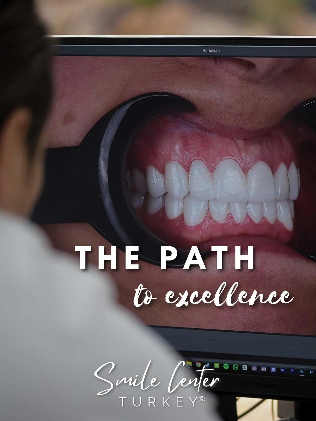 Clinician reviewing high-resolution dental photography on screen at Smile Center Turkey®